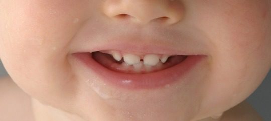 Dientes de bebé
