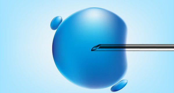 ¿En qué consiste la fecundación in vitro?