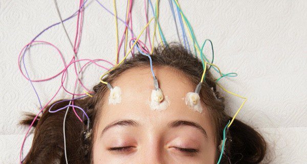 El electroencefalograma es la prueba principal para el diagnóstico y seguimiento de la epilepsia