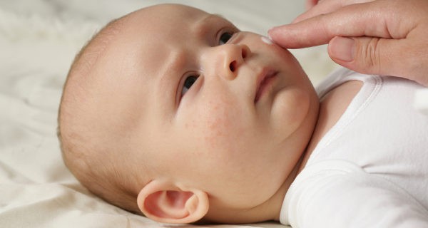 Echando crema en la cara del bebe