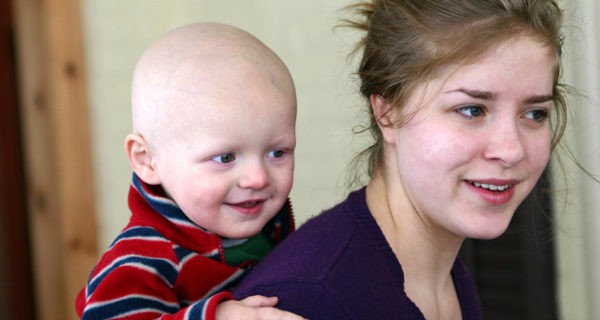Niño con cáncer