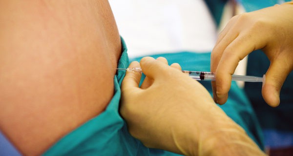 anestesia epidural