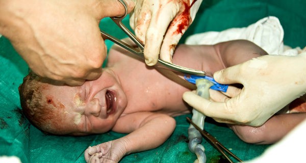cortando el cordón umbilical