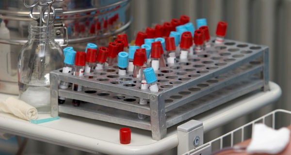 muestras de sangre