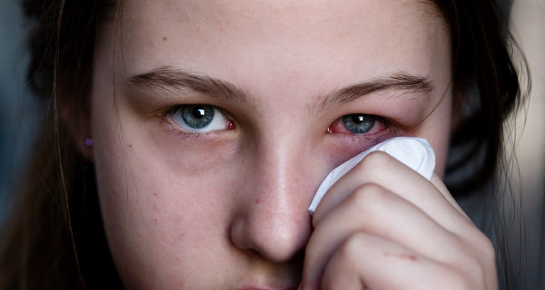 niña con conjuntivitis
