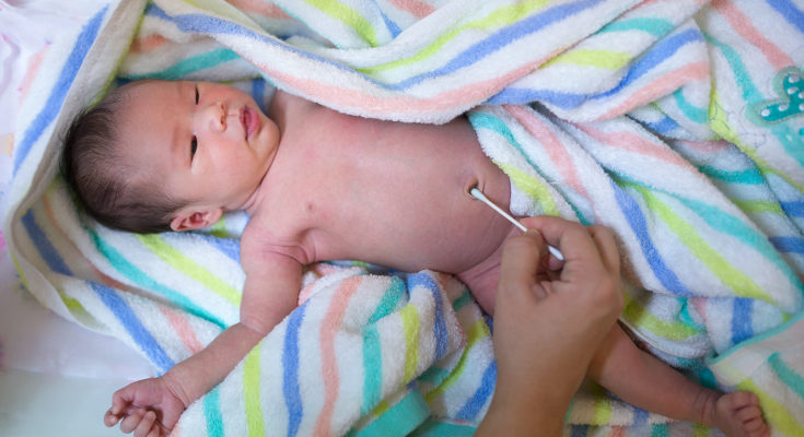 La onfalitis es la infección del ombligo tras caer el cordón umbilical