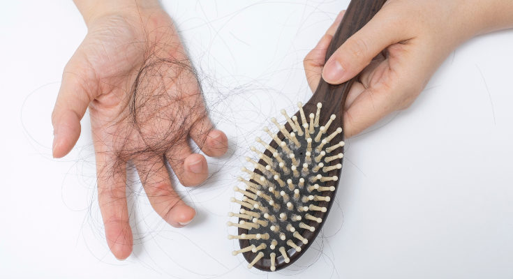 Las causas de la alopecia en la juventud suelen ser genéticas