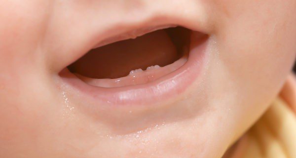 Los dientes empiezan a salir a partir de los 6 meses