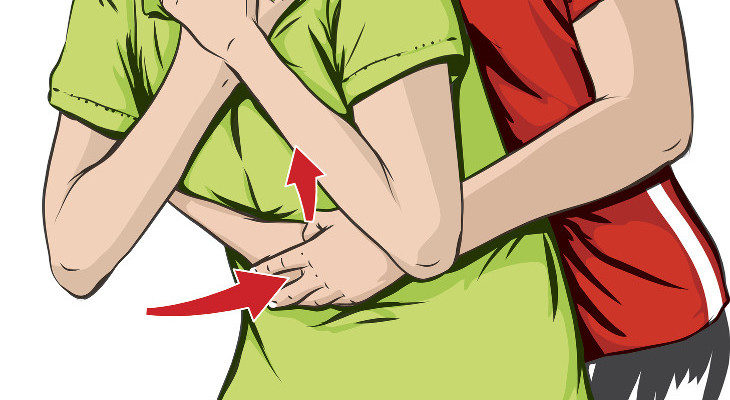 En niños podemos aplicar la maniobra de Heimlich