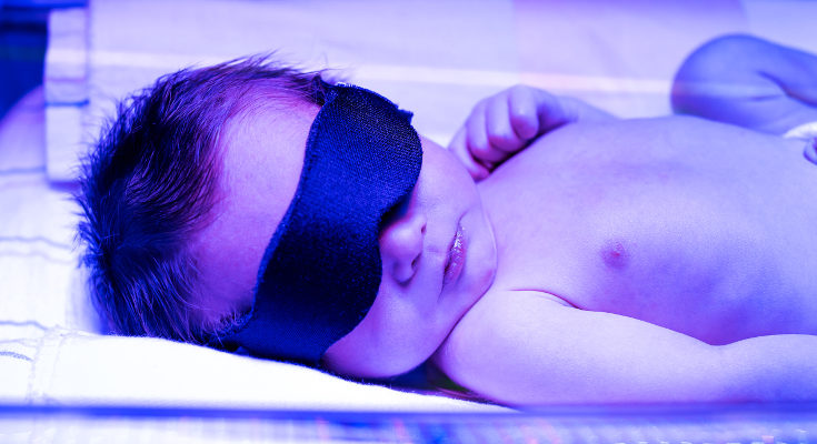 Sólo en algunos casos la ictericia necesita sesiones de fototerapia, si no, basta con exponer al bebé al sol