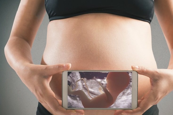 La abrupción placentaria grave es un factor de riesgo importante para la muerte fetal
