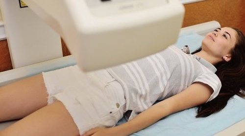 Hipertiroidismo en la adolescencia