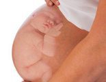 Cómo quedarse embarazada tras un embarazo ectópico o extrauterino