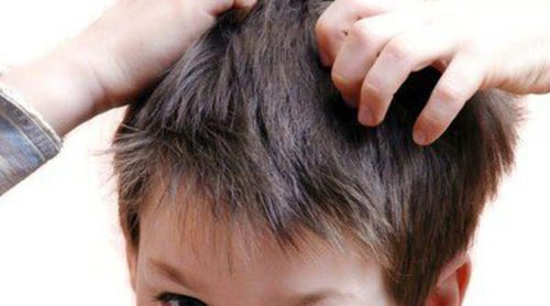 Pediculosis: actúa contra los piojos