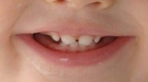 La higiene bucal de tu bebé, clave para evitar enfermedades