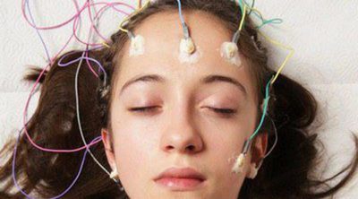 Epilepsia: síntomas y tratamiento
