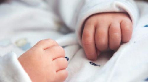 El síndrome de aspiración meconial en el bebé recién nacido