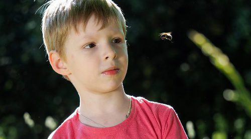 Qué hacer ante las picaduras de abeja en niños