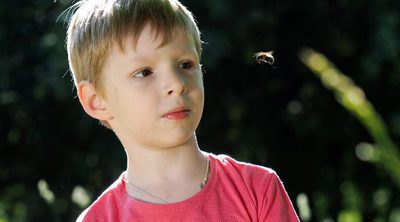 Qué hacer ante las picaduras de abeja en niños