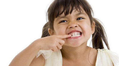 Causas y tratamiento del bruximo en niños