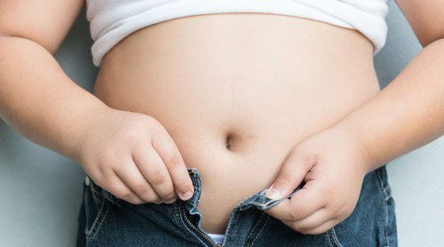 ¿Por qué es importante prevenir la obesidad infantil?