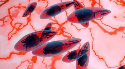 Toxoplasma gondii, el parásito que deben evitar las embarazadas