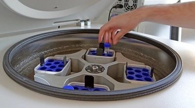 Qué debes saber antes de empezar un tratamiento de fertilidad