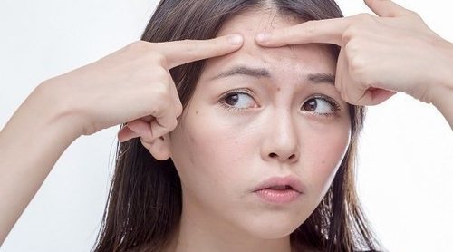 El acné en adolescentes y adultos jóvenes