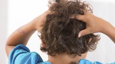 Qué hacer si tu hijo tiene piojos o pediculosis