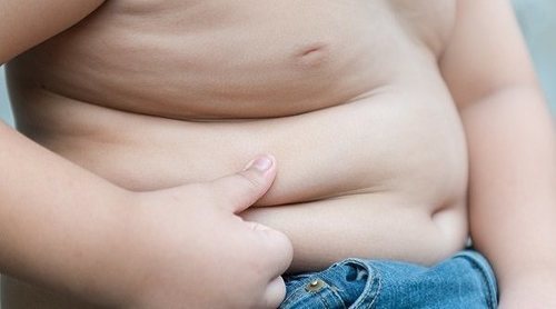 Qué deben saber los padres para evitar la obesidad infantil