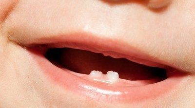 Calendario de los dientes de leche