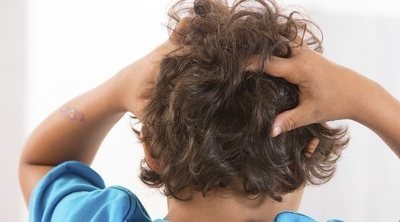 Tratamientos más eficaces para eliminar los piojos