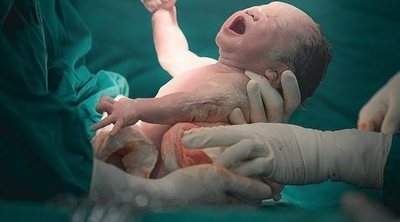 ¿Es mejor un parto natural o una cesárea?