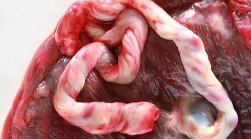 Qué puedes hacer con la placenta después del parto