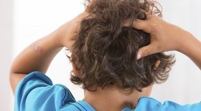 Piojos: por qué es tan difícil acabar con las liendres