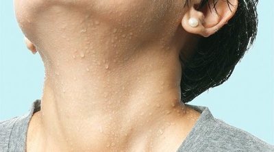 Sudoración excesiva en adolescentes, ¿cómo actuar?