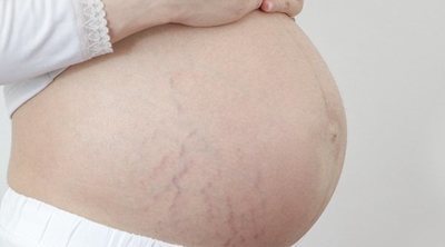 Por qué tus embarazos NO serán iguales