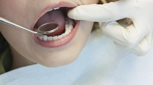 Ir al dentista con niños con NEE