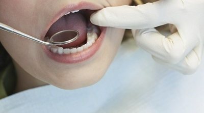 Ir al dentista con niños con NEE